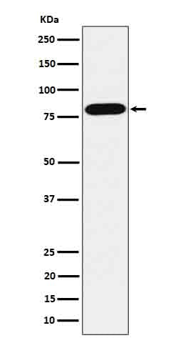 ABCD1 / ALD  (12L9) Rabbit Monoclonal Antibody