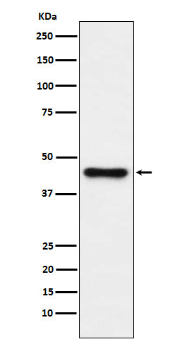 ABHD5 (2H2) Rabbit Monoclonal Antibody