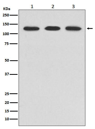 ABL2 (7J9) Rabbit Monoclonal Antibody