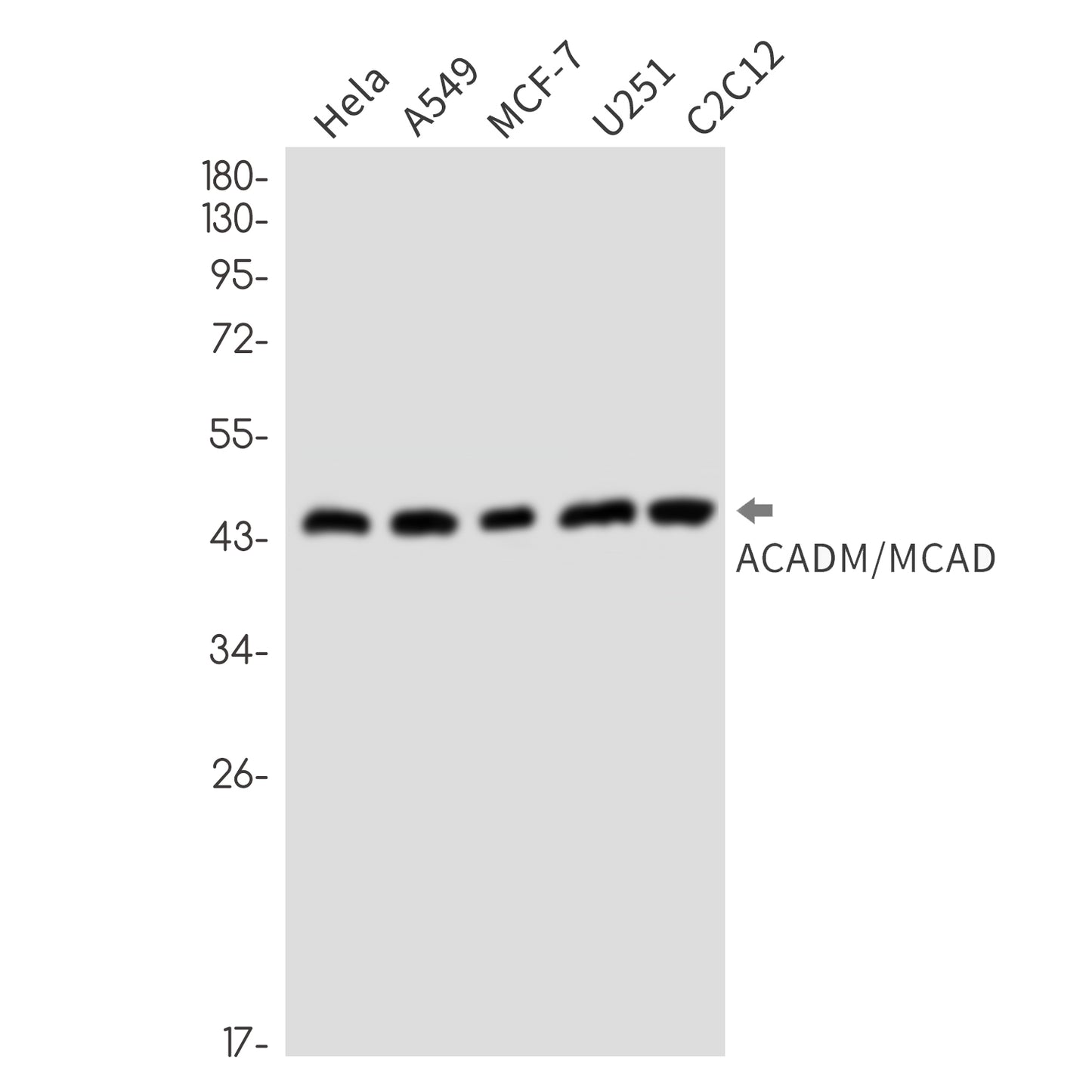 ACADM (7K9) Rabbit Monoclonal Antibody