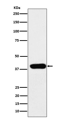 ADA (11N15) Rabbit Monoclonal Antibody
