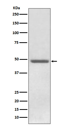 ADFP (18T3) Rabbit Monoclonal Antibody