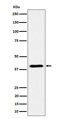 ADH4 (17T19) Rabbit Monoclonal Antibody
