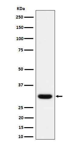 Adiponectin (5N3) Rabbit Monoclonal Antibody