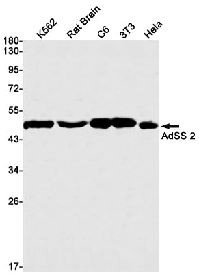 AdSS 2 (9P17) Rabbit Monoclonal Antibody