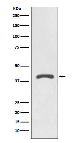 AGTR2 (2I6) Rabbit Monoclonal Antibody