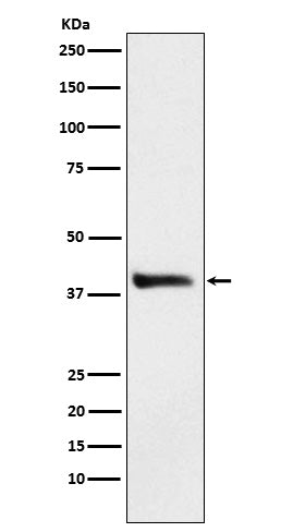 Alcohol Dehydrogenase (17M10) Rabbit Monoclonal Antibody