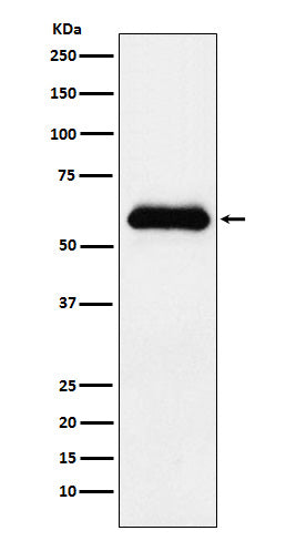 alpha 1 Antichymotrypsin  (17X18) Rabbit Monoclonal Antibody