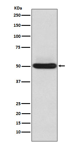alpha Sarcoglycan (14V11) Rabbit Monoclonal Antibody