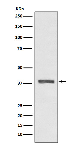 AMPK beta 1 (3Y15) Rabbit Monoclonal Antibody