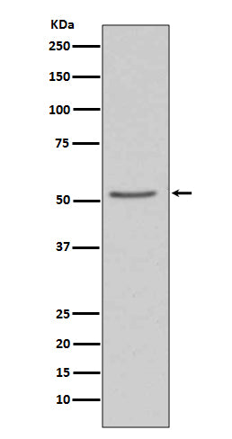 Angiotensinogen (15J4) Rabbit Monoclonal Antibody