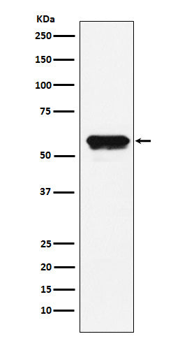 Angiotensinogen (2C9) Rabbit Monoclonal Antibody