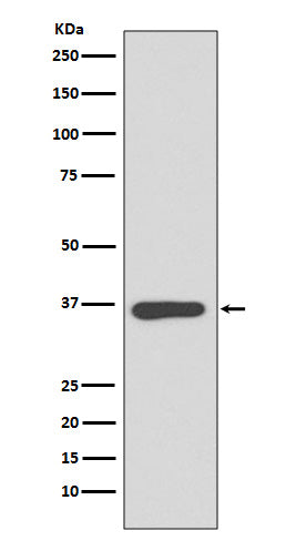 Annexin A10 (14O15) Rabbit Monoclonal Antibody