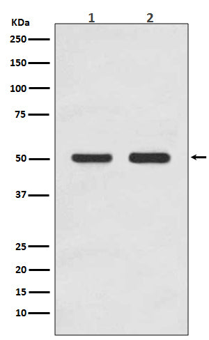 AP2M1 (5T7) Rabbit Monoclonal Antibody