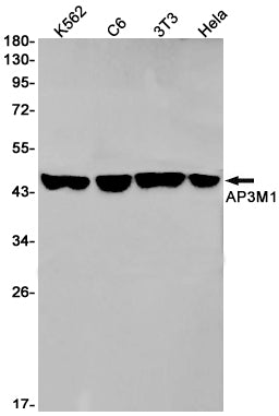 AP3M1 (16F4) Rabbit Monoclonal Antibody