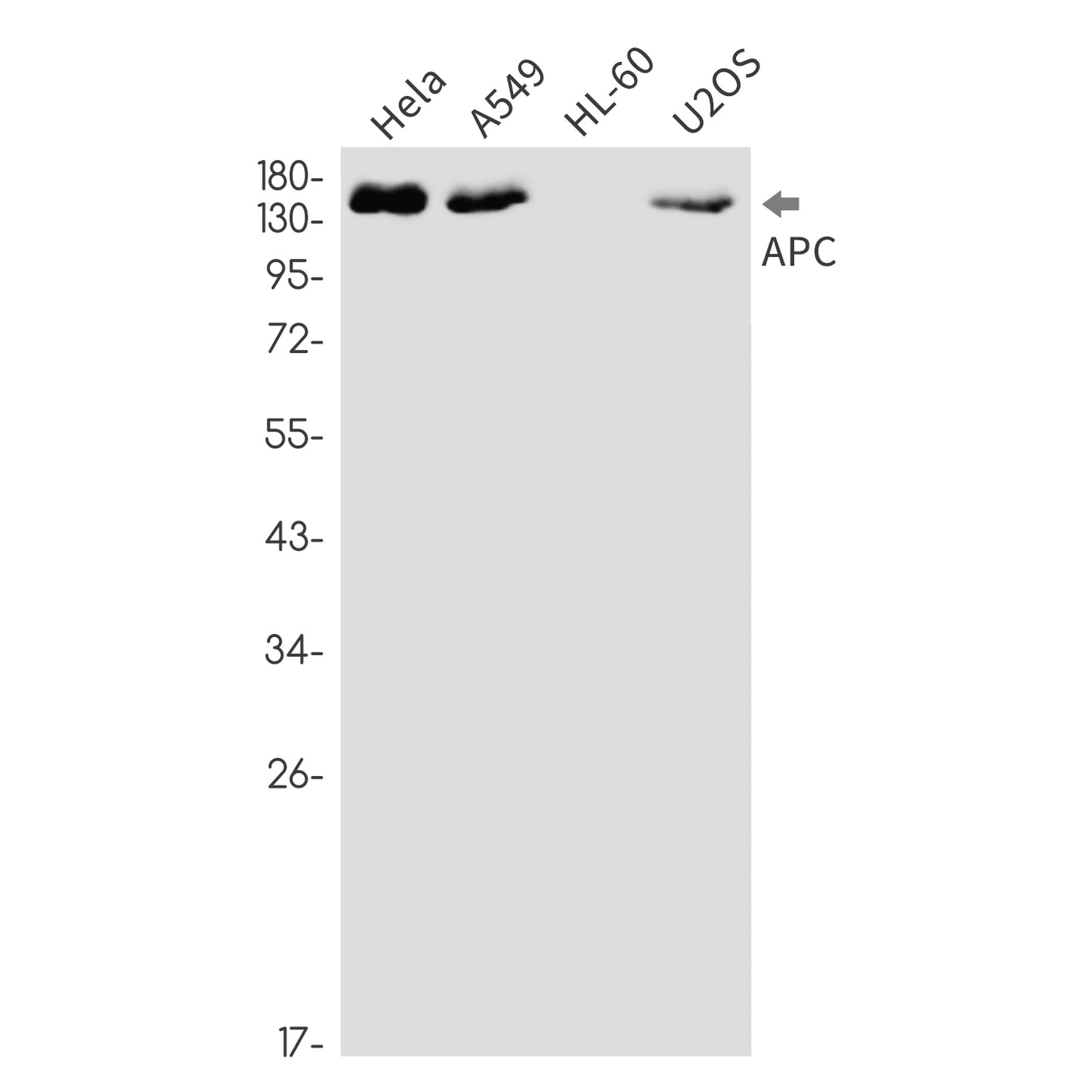 APC (19Y7) Rabbit Monoclonal Antibody