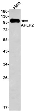 APLP2 (17Z11) Rabbit Monoclonal Antibody