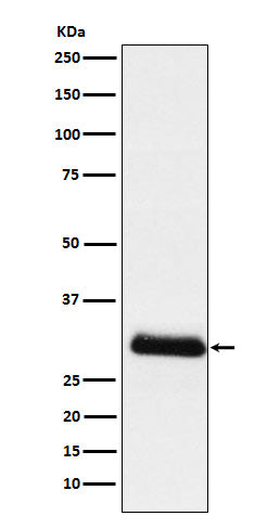 ApoD (18D19) Rabbit Monoclonal Antibody