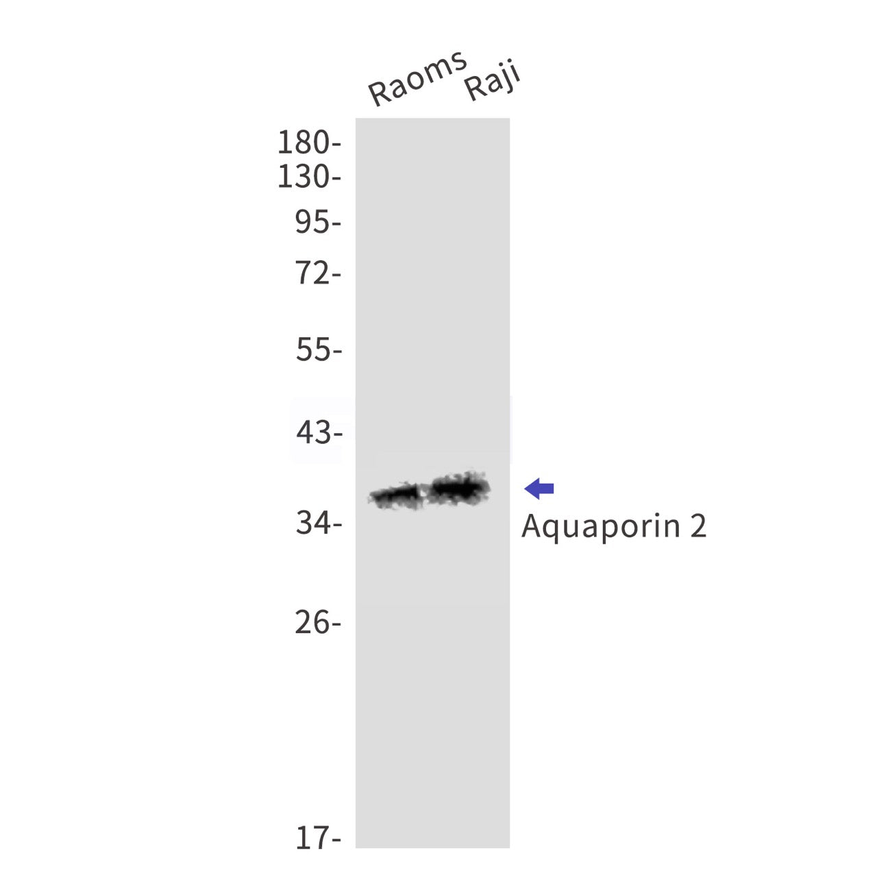 Aquaporin 2 (13E19) Rabbit Monoclonal Antibody