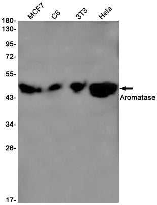 Aromatase (4R11) Rabbit Monoclonal Antibody