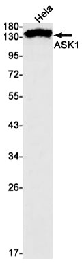 ASK1 (13A13) Rabbit Monoclonal Antibody