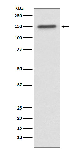 ASPP2 (7U15) Rabbit Monoclonal Antibody