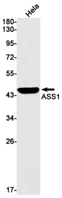 ASS1 (17N16) Rabbit Monoclonal Antibody