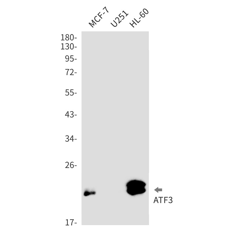 ATF3 (14D8) Rabbit Monoclonal Antibody