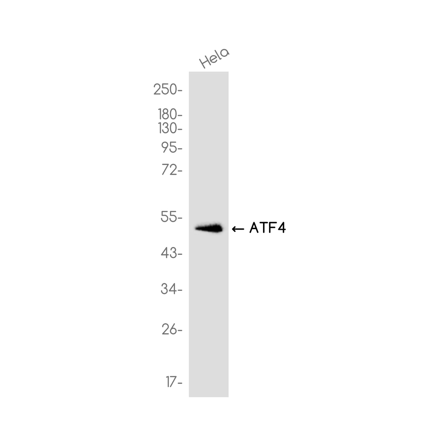 ATF4 (16F19) Rabbit Monoclonal Antibody