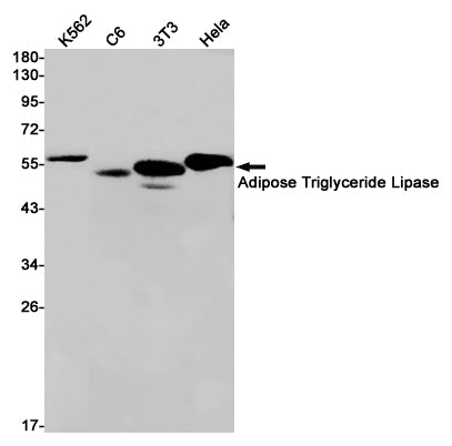 ATGL / PNPLA2 (16Z14) Rabbit Monoclonal Antibody