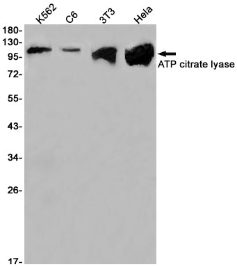 ATP citrate lyase  (8L17) Rabbit Monoclonal Antibody