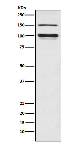 ATP1A3 (5V12) Rabbit Monoclonal Antibody