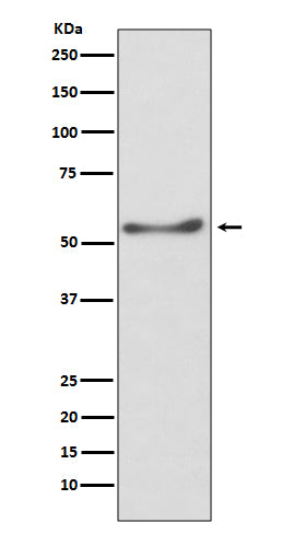ATP5A1 (11Q15) Rabbit Monoclonal Antibody
