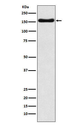 ATP7b (3D19) Rabbit Monoclonal Antibody