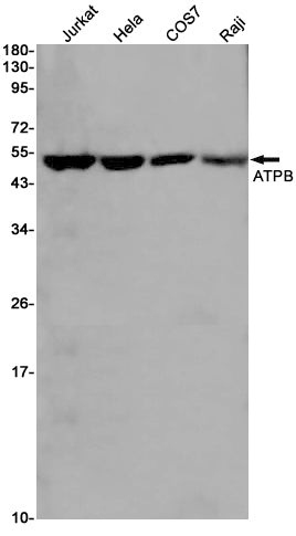 ATPB (19W10) Rabbit Monoclonal Antibody