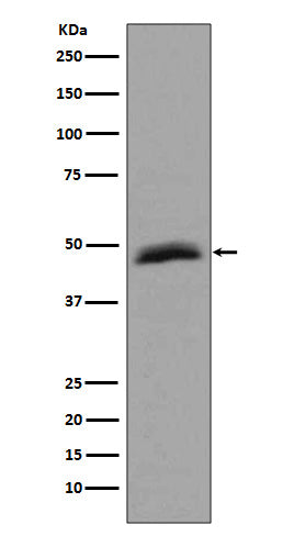 Aurora A (8C5) Rabbit Monoclonal Antibody