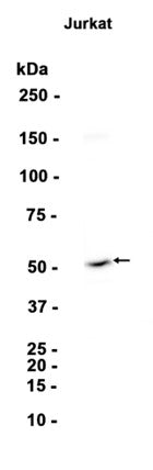 BAF57/SMARCE1 (16D16) Rabbit Monoclonal Antibody