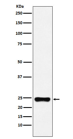 BAG2 (17W11) Rabbit Monoclonal Antibody