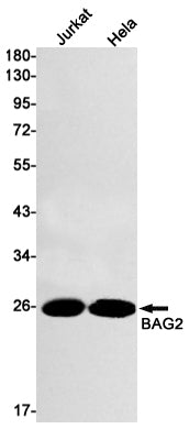 BAG2 (9Z17) Rabbit Monoclonal Antibody