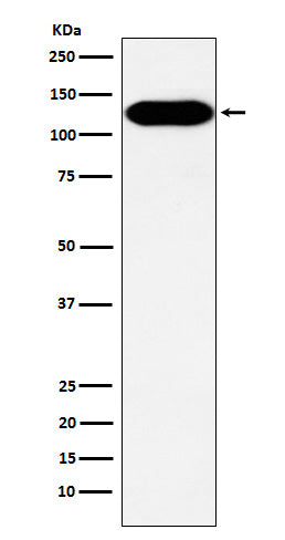 BCAR1 (5K7) Rabbit Monoclonal Antibody