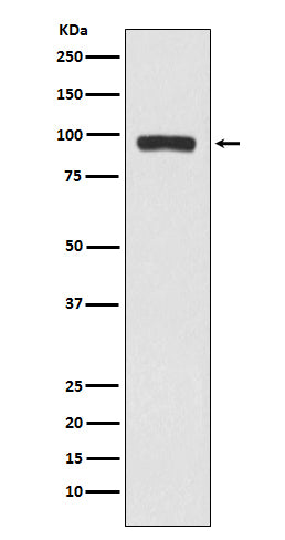 BCHE (12S11) Rabbit Monoclonal Antibody