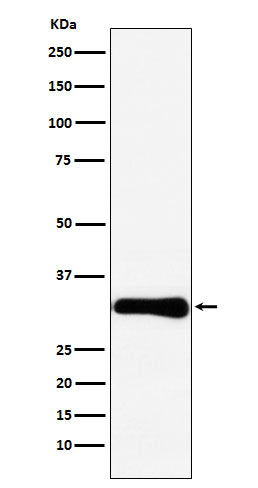 Bcl10 (9M3) Rabbit Monoclonal Antibody