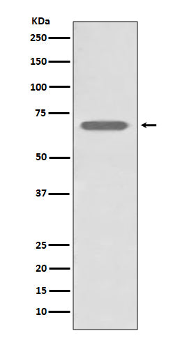 beta 2 Adrenergic Receptor (4E18) Rabbit Monoclonal Antibody