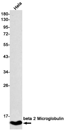 beta 2 Microglobulin (18W13) Rabbit Monoclonal Antibody