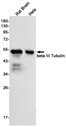 beta III Tubulin (8F12) Rabbit Monoclonal Antibody