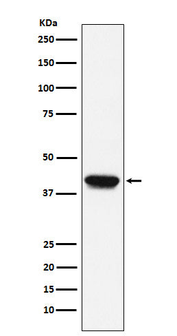Biglycan (9M18) Rabbit Monoclonal Antibody