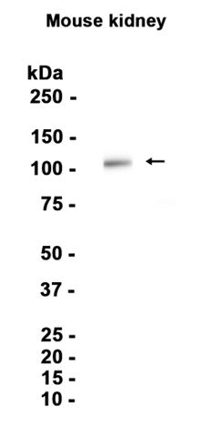 Cadherin 16 (15J2) Rabbit Monoclonal Antibody