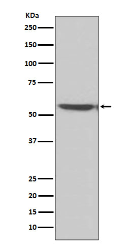 Calcineurin A (15E13) Rabbit Monoclonal Antibody
