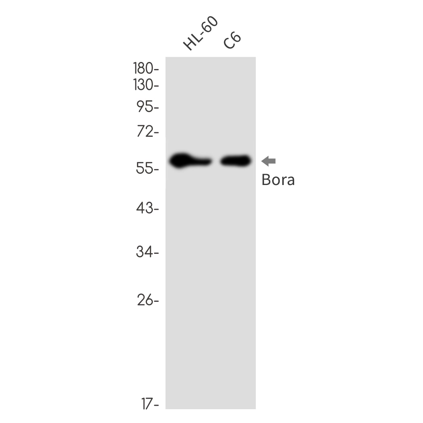Caldesmon (3X14) Rabbit Monoclonal Antibody