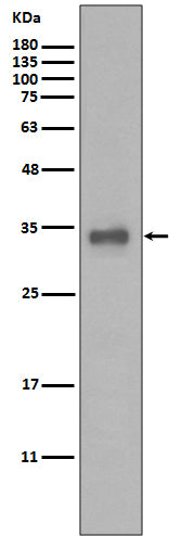 Calponin  (6N15) Rabbit Monoclonal Antibody